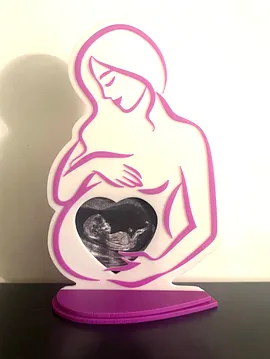 Ultrason Fotoğrafı Çerçevesi Beyaz